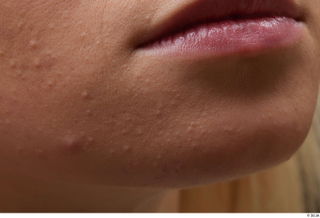 HD Face Skin Unaisa cheek chin lips mouth skin pores…